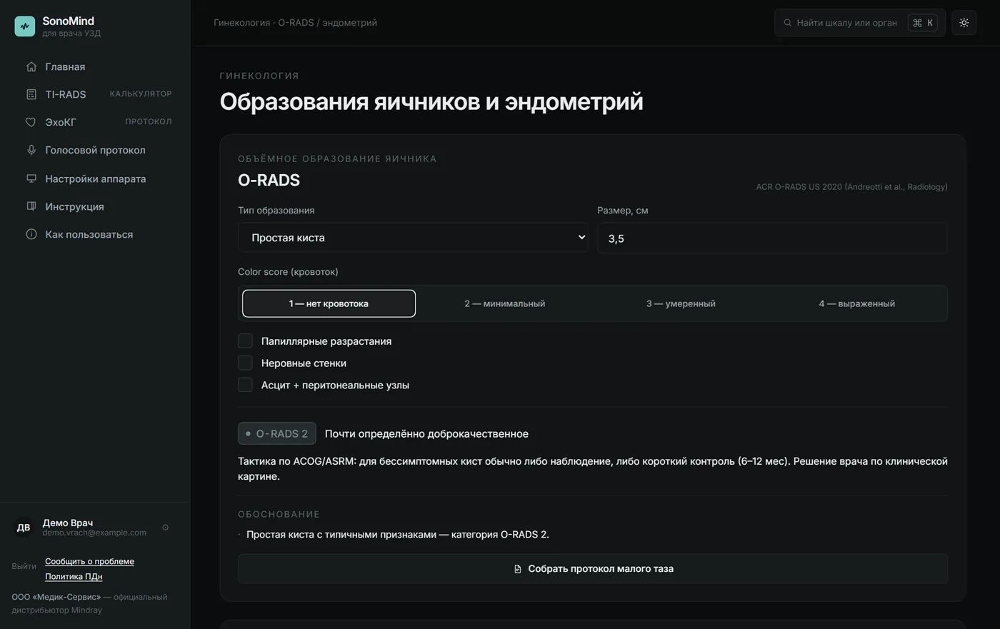 Калькулятор O-RADS в SonoMind: простая киста 3,5 см, категория O-RADS 2 и тактика