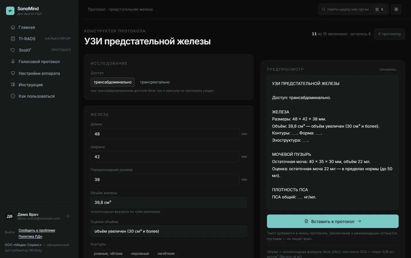 Конструктор протокола УЗИ предстательной железы в SonoMind: объём 39,8 см³ и остаточная моча